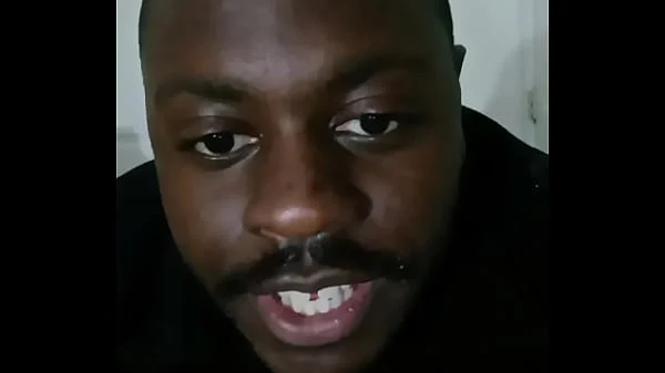 Introducing how my skin also gets sometimes when the weather gets hot and sunny in the summertime while wearing flasher coat to cover the rest of my body from developing too much allergies2