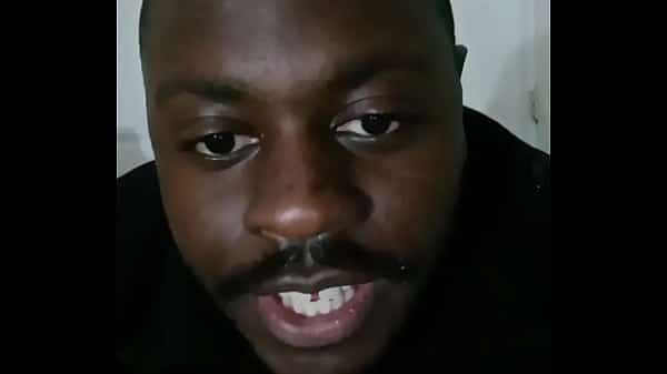 Introducing how my skin also gets sometimes when the weather gets hot and sunny in the summertime while wearing flasher coat to cover the rest of my body from developing too much allergies2