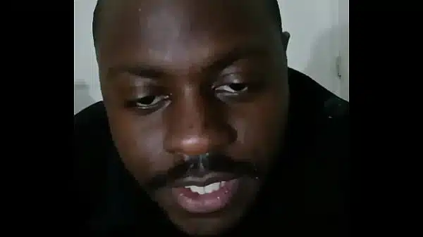 Introducing how my skin also gets sometimes when the weather gets hot and sunny in the summertime while wearing flasher coat to cover the rest of my body from developing too much allergies4